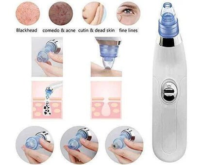 5 in 1 Blackhead Removal Machine